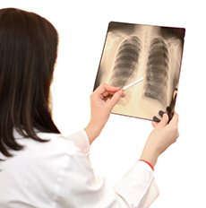 Doctor Xray Lungs of Smoker-Thinkstock-643021258 (sm)